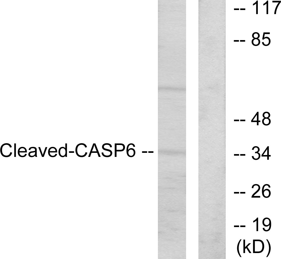 1 - Cleaved-Caspase-6 p18 (D162) Polyclonal Antibody AP63082