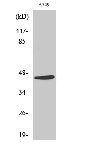 1 - Cleaved-MASP-1 HC (R448) Polyclonal Antibody AP63172