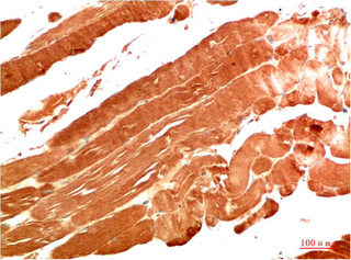14 - NBR1 mouse Monoclonal Antibody(7C3) AP63837