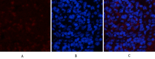 3 - NBR1 mouse Monoclonal Antibody(7C3) AP63837