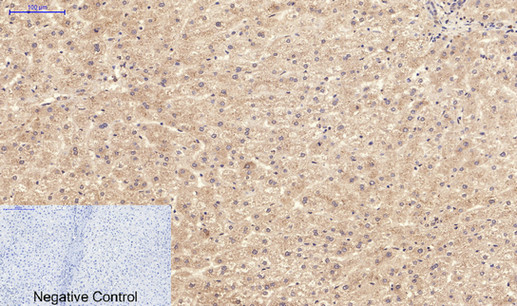 14 - NBR1 mouse Monoclonal Antibody(7C3) AP63837