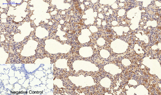 14 - NBR1 mouse Monoclonal Antibody(7C3) AP63837