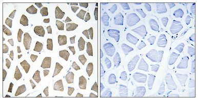 14 - PI 3-kinase p85/p55 (phospho Tyr467/199) Polyclonal Antibody AP67156