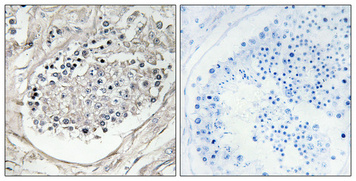 14 - PI 3-kinase p85/p55 (phospho Tyr467/199) Polyclonal Antibody AP67156