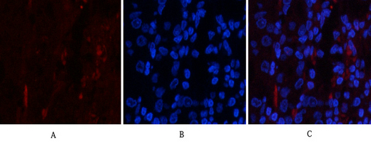 14 - PI 3-kinase p85/p55 (phospho Tyr467/199) Polyclonal Antibody AP67156