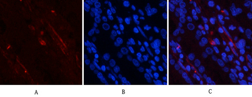 14 - PI 3-kinase p85/p55 (phospho Tyr467/199) Polyclonal Antibody AP67156