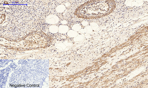 14 - PI 3-kinase p85/p55 (phospho Tyr467/199) Polyclonal Antibody AP67156