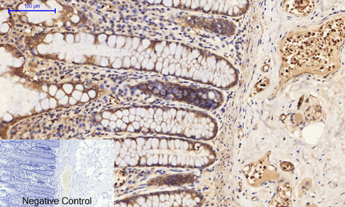 14 - PI 3-kinase p85/p55 (phospho Tyr467/199) Polyclonal Antibody AP67156
