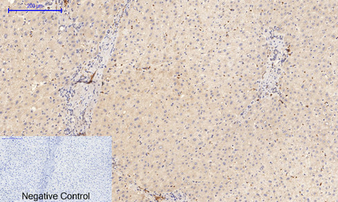 14 - PI 3-kinase p85/p55 (phospho Tyr467/199) Polyclonal Antibody AP67156