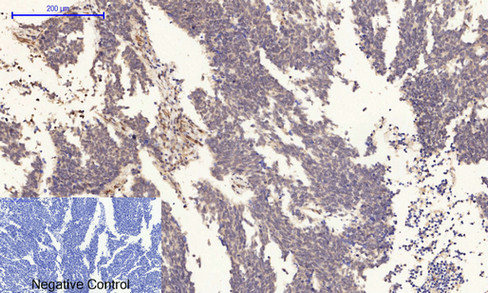 14 - PI 3-kinase p85/p55 (phospho Tyr467/199) Polyclonal Antibody AP67156