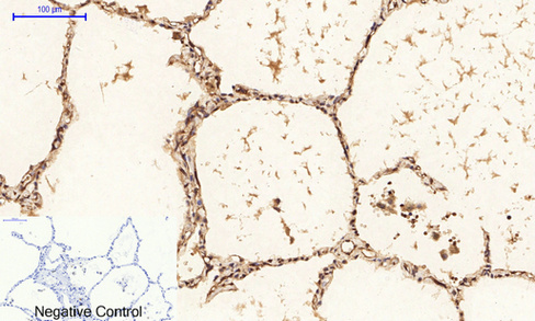 14 - PI 3-kinase p85/p55 (phospho Tyr467/199) Polyclonal Antibody AP67156