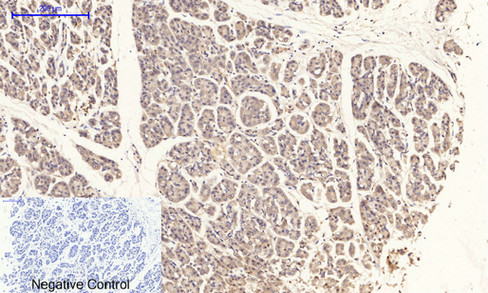 14 - PI 3-kinase p85/p55 (phospho Tyr467/199) Polyclonal Antibody AP67156