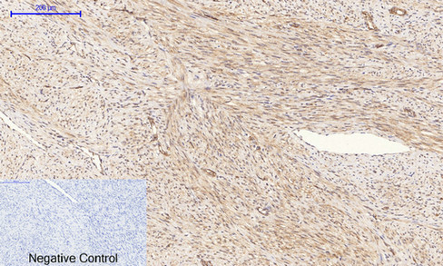 14 - PI 3-kinase p85/p55 (phospho Tyr467/199) Polyclonal Antibody AP67156