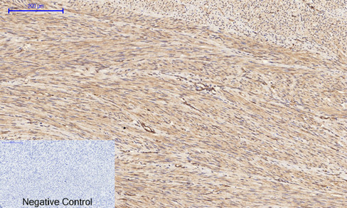 14 - PI 3-kinase p85/p55 (phospho Tyr467/199) Polyclonal Antibody AP67156