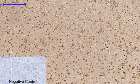 14 - PI 3-kinase p85/p55 (phospho Tyr467/199) Polyclonal Antibody AP67156