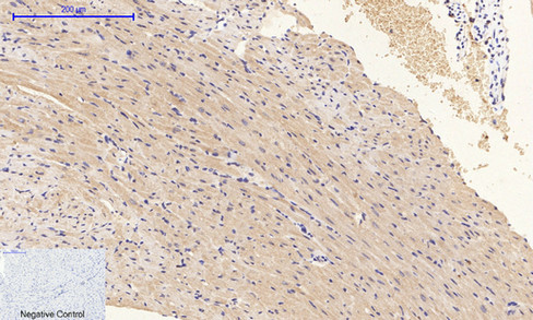 14 - PI 3-kinase p85/p55 (phospho Tyr467/199) Polyclonal Antibody AP67156