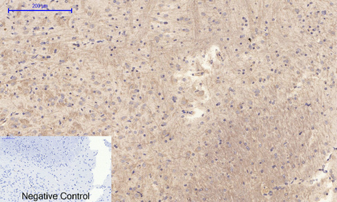 14 - PI 3-kinase p85/p55 (phospho Tyr467/199) Polyclonal Antibody AP67156
