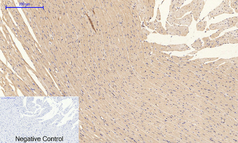 14 - PI 3-kinase p85/p55 (phospho Tyr467/199) Polyclonal Antibody AP67156