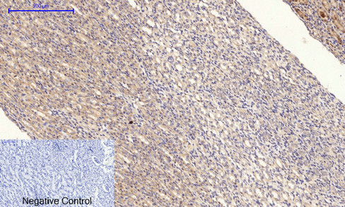 14 - PI 3-kinase p85/p55 (phospho Tyr467/199) Polyclonal Antibody AP67156
