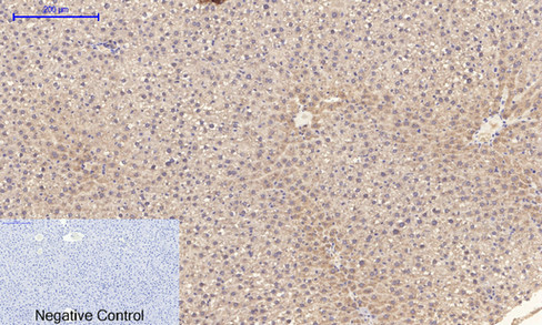 14 - PI 3-kinase p85/p55 (phospho Tyr467/199) Polyclonal Antibody AP67156