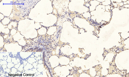 14 - PI 3-kinase p85/p55 (phospho Tyr467/199) Polyclonal Antibody AP67156
