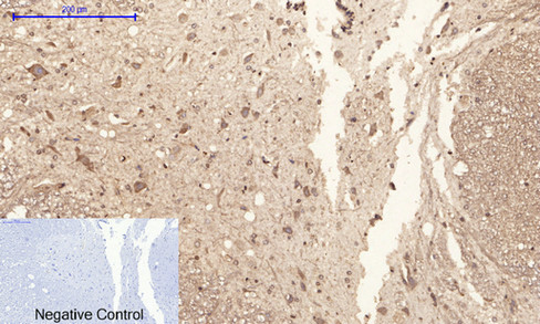 14 - PI 3-kinase p85/p55 (phospho Tyr467/199) Polyclonal Antibody AP67156