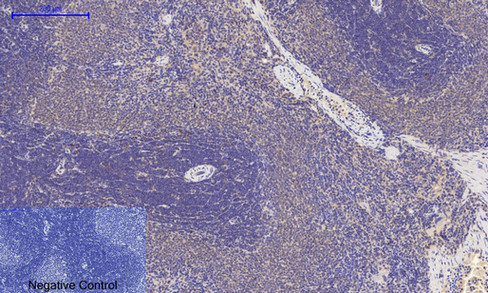 14 - PI 3-kinase p85/p55 (phospho Tyr467/199) Polyclonal Antibody AP67156