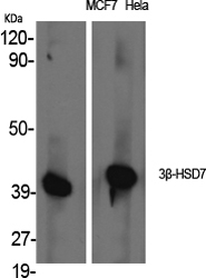 1 - 3β-HSD7 Polyclonal Antibody AP68198