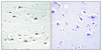 14 - Actinin-α1/2/3/4 Polyclonal Antibody AP68284