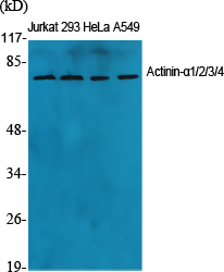 1 - Actinin-α1/2/3/4 Polyclonal Antibody AP68284