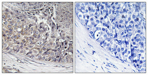 14 - ADCK4 Polyclonal Antibody AP68305