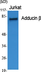 1 - Adducin β Polyclonal Antibody AP68309