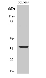1 - Apaf-1-ALT Polyclonal Antibody AP68438
