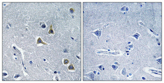 14 - ARRDC2 Polyclonal Antibody AP68522