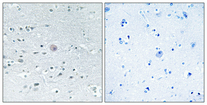 1 - Arylsulfatase F Polyclonal Antibody AP68533