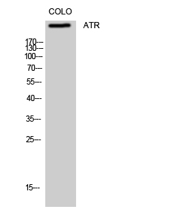 1 - ATR Polyclonal Antibody AP68599
