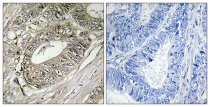 14 - BIG2 Polyclonal Antibody AP68672
