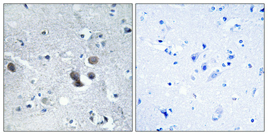 14 - BIG2 Polyclonal Antibody AP68672