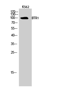 1 - BTR1 Polyclonal Antibody AP68728