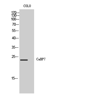 1 - CaBP7 Polyclonal Antibody AP68773