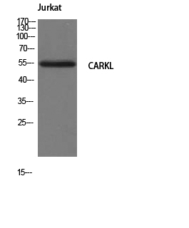 1 - CARKL Polyclonal Antibody AP68822