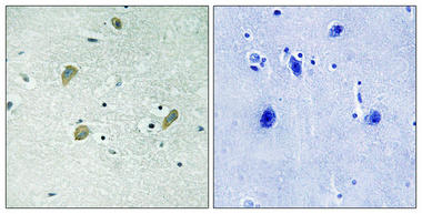 14 - Casein Kinase Iγ1/2/3 Polyclonal Antibody AP68831