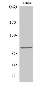 1 - CCP2 Polyclonal Antibody AP68892