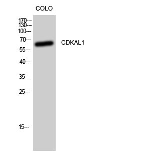 1 - CDKAL1 Polyclonal Antibody AP69024