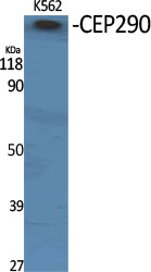1 - CEP290 Polyclonal Antibody AP69042