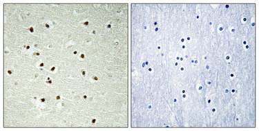 14 - CEP70 Polyclonal Antibody AP69047