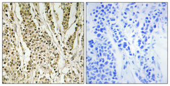 14 - Cerebral 1 Polyclonal Antibody AP69055
