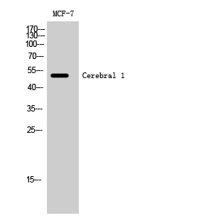 1 - Cerebral 1 Polyclonal Antibody AP69055