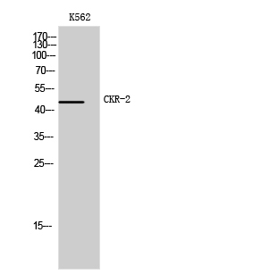 1 - CKR-2 Polyclonal Antibody AP69117
