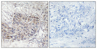 14 - CNK1 Polyclonal Antibody AP69181